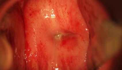 Az illata a kellemetlen vaginális, hal, állott, rossz, szúrós szaga a halak, a vas, szikra szag (vaginális) Az illata a kellemetlen vaginális, hal, állott, rossz, szúrós szaga a halak, a vas, szikra szag
