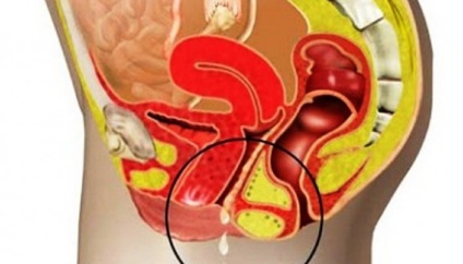 Az illata a kellemetlen vaginális, hal, állott, rossz, szúrós szaga a halak, a vas, szikra szag (hal) Az illata a kellemetlen vaginális, hal, állott, rossz, szúrós szaga a halak, a vas, szikra szag