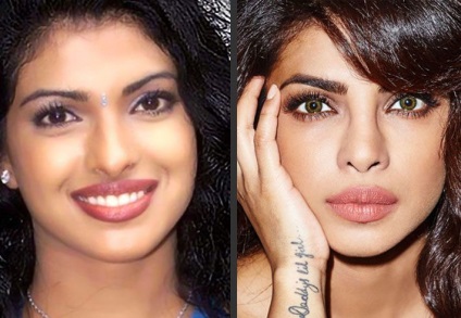Bollywood stars megváltozott megjelenése a műanyag
