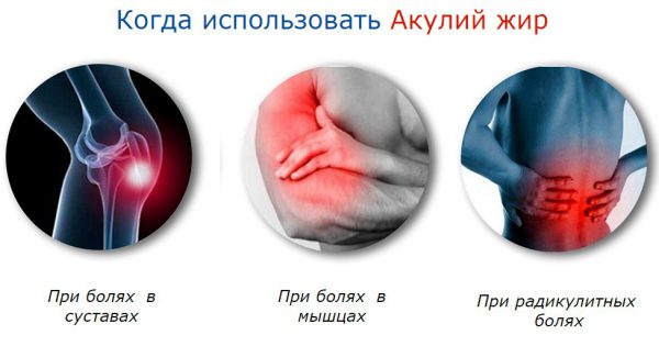 Shark olaj kapszula Használati és az eredményekről visszajelzést (a bőr haj köröm) Shark olaj kapszula Használati és visszajelzést az eredményeket