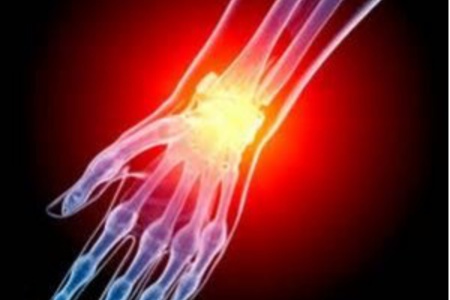 Arthritis a Csuklóízület - okai, tünetei és kezelése