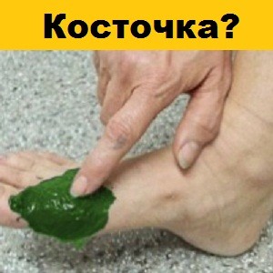 Baktériumok a kezében egy személy, amely a baktériumok piszkos kezek (kéz) Baktériumok, amelyek emberi kéz van baktériumokkal szennyezett kezek