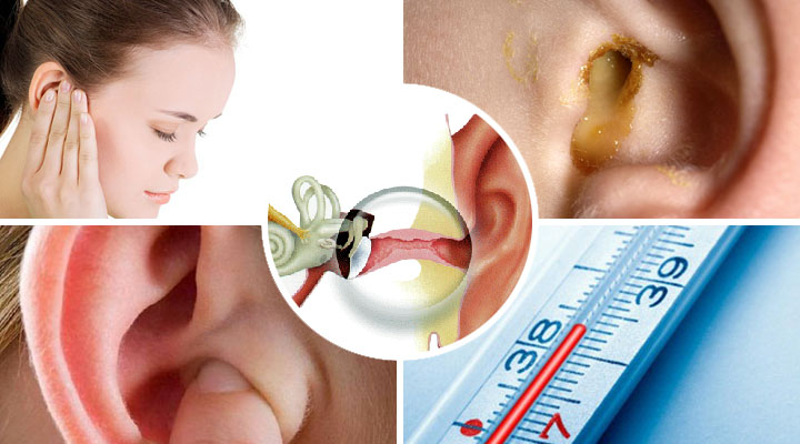 Diffúz otitis külső fül - tünetek és kezelés