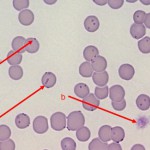 Gemobartonellez macskák (gemobartonellez) Gemobartonellez macskák