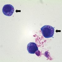 Emberi granulocytás anaplasmosis