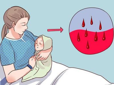 Vérzés, szülés utáni kiemelni, hogyan jön, milyen hosszú a norma