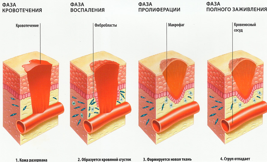 Kenőcs égési forrásban (hólyagos) (kenőcs) Kenőcs égési forrásban (hólyagos)
