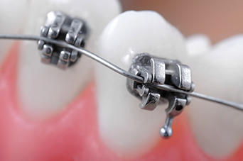 Irány a fogorvosok tevékenység