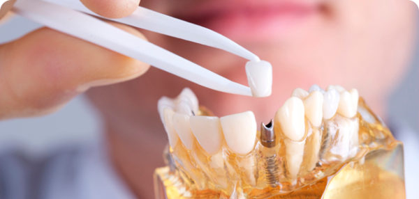 Irány a fogorvosok tevékenység