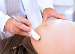 A inhomogén szerkezete a placenta (heterogén) A inhomogén szerkezete a placenta
