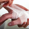 Burn forró tünetek, a kezelés és az elsősegély (égési) Burn forrásban tünetei, kezelése és elsősegély