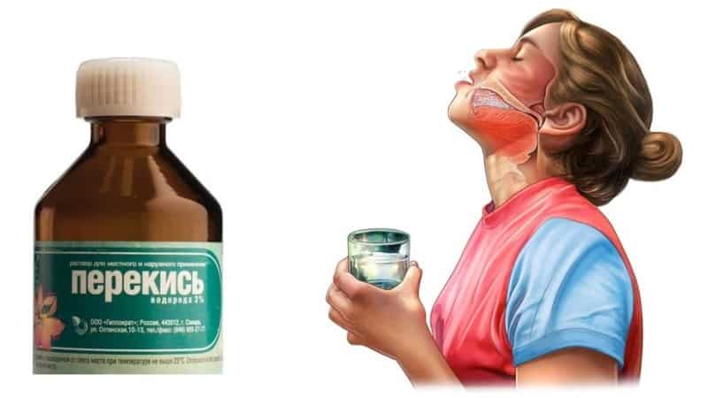 Hidrogén-peroxid stomatitis gyermekek és felnőttek (peroxid) A hidrogén-peroxid egy stomatitis gyermekeknél és felnőtteknél