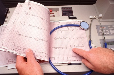 Sinus arrhythmia gyermekekben a súlyos és közepes, 7, 6, 10, 9 év (kifejezve) Sinus arrhythmia gyermekek középsúlyos és súlyos, 7, 6, 10, 9 éves