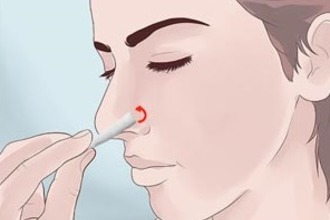 Tampon és turundy orrát a sinus - hogyan kell csinálni
