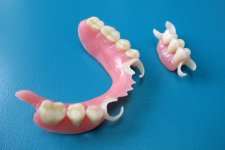Hőre lágyuló - innováció kivehető fogpótlások - dentalfabrik (kivehető) Hőre lágyuló - innováció kivehető fogpótlások - dentalfabrik