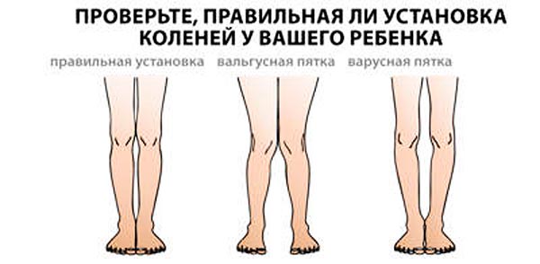 Feszes pólya egy újszülött (fotó és videó) (hónapjában baba élete) Feszes pólya egy újszülött (fotó és videó)