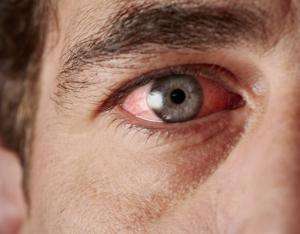 Eye fáradtság - tünetei és okai; szindróma kezelésére népi jogorvoslati és gyakorlatok