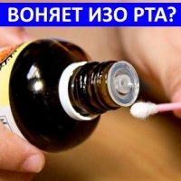 Vertebrogenic cervicalgia mi ez, tünetei és kezelése (cervicalgia) Vertebrogenic cervicalgia mi ez, tünetei és kezelése