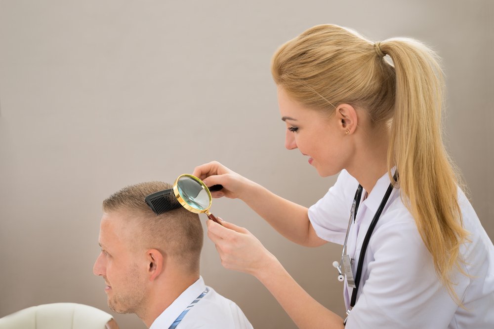 Hajhullás oka - seborrheás dermatitis (bölcső cap) Hajhullás oka - seborrheás dermatitis