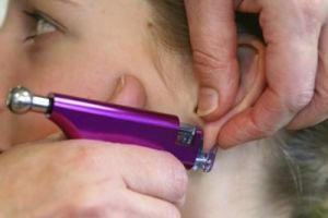 Gyulladás fülcimpa okok és a kezelés (gyulladás) Gyulladás fülcimpa okok és a kezelés