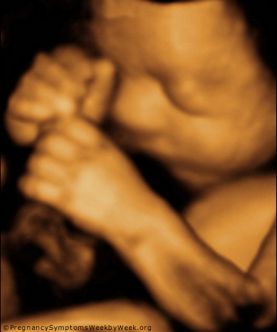 3D (3D) terhességi ultrahang
