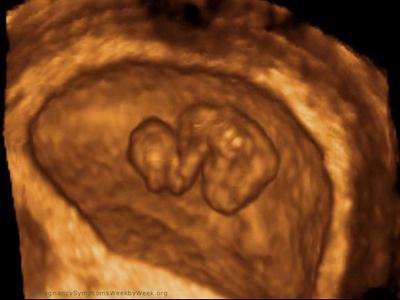 3D (3D) terhességi ultrahang