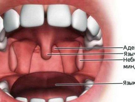 Adenoid arc típusú gyermek, ahol kell, és úgy néz ki, mint, fotók