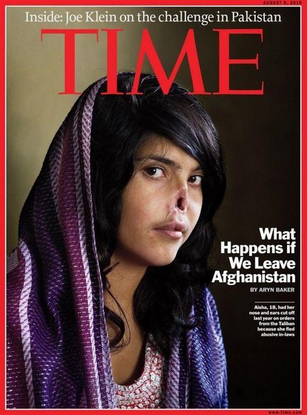 Afgán lány Aisha készített új orr - hírek képekben
