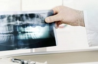 Dental vonal (Dental) fogászati Online