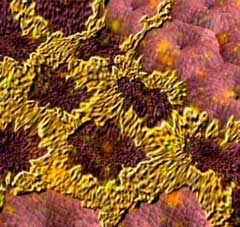 Hepatitis d olyan, hogy például a továbbított, a tünetek és a kezelés (tünetek) Hepatitis d, mi ez, hogyan továbbítjuk, tünetei és kezelése