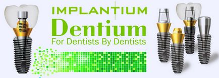 Az implantátumok implantium telepítés, funkciók, javallatok és ellenjavallatok (implantium) Az implantátumok implantium telepítés, funkciók, jelzések és ellenjavallatok