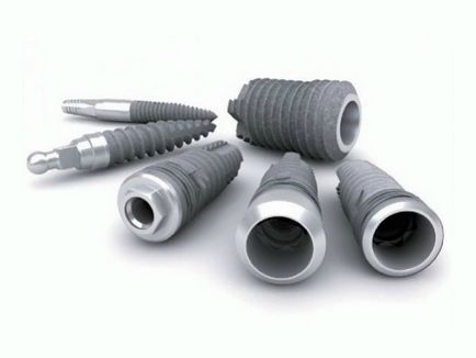 Az implantátumok implantium telepítés, funkciók, javallatok és ellenjavallatok (implantium) Az implantátumok implantium telepítés, funkciók, jelzések és ellenjavallatok