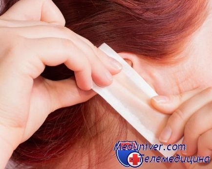 Hogyan lehet eltávolítani a hajat a fül belső módszerek