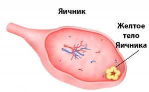 Luteális ciszta a bal petefészek, és különösen a fejlesztési módszerek kezelési neoplazma