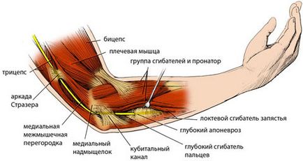 A mediális kábelt a plexus brachialis anatómiai képekben