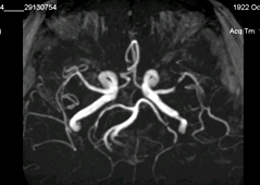 MR szakértő a diagnosztikai MRI Neurology (szakértő) MR szakértő a diagnosztikai MRI Neurology