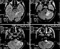 MRI neurológia - árak Moszkvában, talált 1581-ben Ár (MRI Neurology) MRI neurológia - árak Moszkvában talált 1581 ár