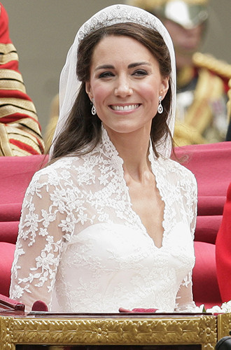 Orr Keyt Middlton és 9. legnépszerűbb formája az orr orrplasztika, Marie Claire (Middleton) Orr Keyt Middlton és 9. legnépszerűbb formája az orr orrplasztika, Marie Claire
