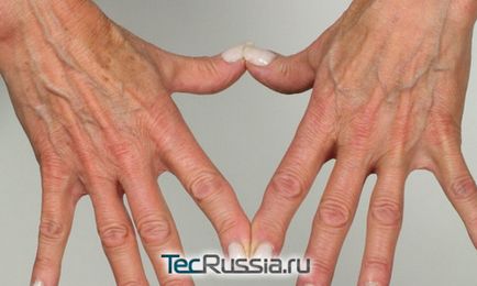 Kézi fiatalítás - hogyan távolítsa el a ráncokat, öregségi foltok és kiálló vénák a kézen