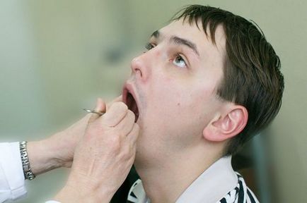 Duzzanat a nyelv alá vagy a nyelv a diagnózis tömítés kezelés