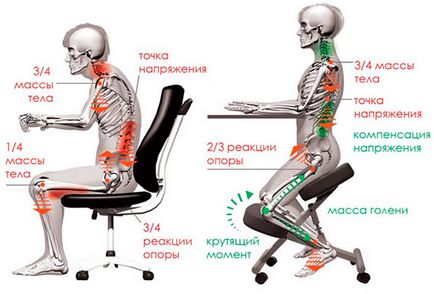 Ortopédiai térd szék a hangsúlyt -, vagy ártalom