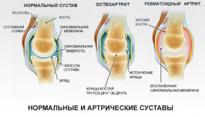 Értékelés: - A aktívnak - kompressziós mandzsetta a derék és a lábak