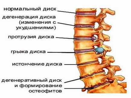 Az emberi gerinc szerkezete a számozás lemez
