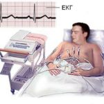 Bradycrotic nagynyomású mi köze bradycardia