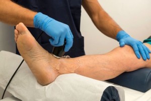 Rheumatoid arthritis Foot Causes, tünetek és kezelés
