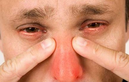 Külön kezelés arcüreggyulladás népi jogorvoslat