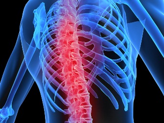 Gerincferdülés fotó fok és leírás megnyilvánulásai (scoliosis) Gerincferdülés fotó leírás fok és megnyilvánulások