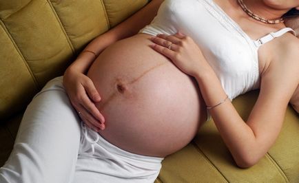 Mellbimbók a terhesség alatt, hogyan kell változtatni udvarok nőknél, milyen érzékenységgel