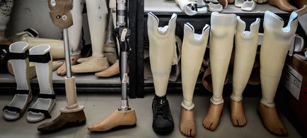 Ez hozta létre egy mesterséges lábat, amely integrált közvetlenül a csont - a high-tech és a fejlett hírek
