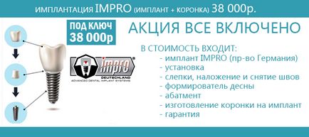 Telepítése fogászati implantátumok, az árak, vélemények, fotók (telepítés) Telepítése fogászati implantátumok, az árak, vélemények, fotók